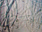 Coremiella cubispora image