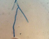 Coremiella cubispora image