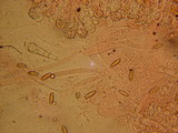 Boletus chrysenteron image