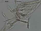 Daldinia macrospora image