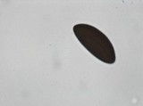 Daldinia macrospora image