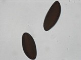 Daldinia macrospora image