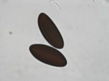 Daldinia macrospora image