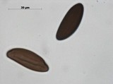 Daldinia macrospora image