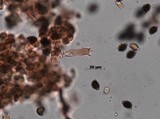 Lacrymaria hypertropicalis image