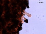 Lacrymaria hypertropicalis image
