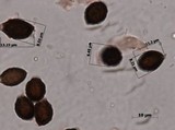 Lacrymaria hypertropicalis image