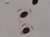 Lacrymaria hypertropicalis image