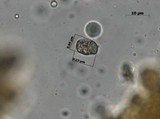 Amanita herrerae image