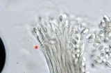 Basidiopycnides albertensis image