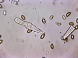 Inocybe laetior image