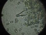 Pluteus petasatus image