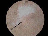 Pseudoclitocybe cyathiformis image