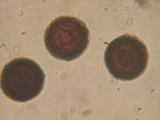 Elaphomyces granulatus image