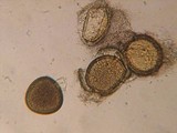 Endogone lactiflua image