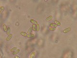 Onygena corvina image