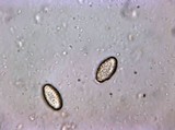 Peziza badia image
