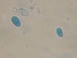 Lepista irina image