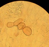 Cystodermella granulosa image