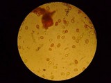 Inonotus hispidus image