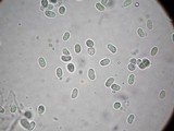 Squamanita umbonata image