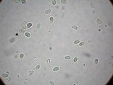 Squamanita umbonata image