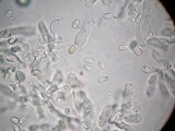 Squamanita umbonata image