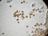 Psilocybe mammillata image