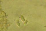 Mycena aciculata image