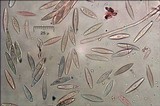 Lachnellula splendens image