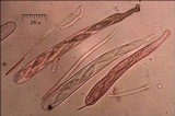Lachnellula splendens image