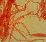 Mycena purpureofusca image