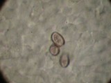 Strobilurus albipilatus image