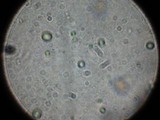 Tricholoma fracticum image