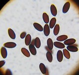 Psathyrella atrospora image
