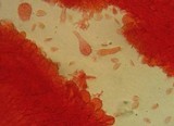 Mycena metata image