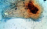Stilbella annulata image