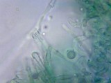 Chlorociboria aeruginosa image