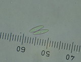 Lepiota magnispora image