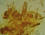 Tremella globispora image