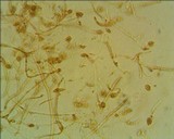 Tremella globispora image