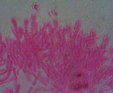 Phlebia radiata image