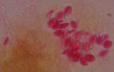 Exidia recisa image