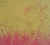 Coryne dubia image
