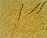 Annulohypoxylon multiforme image