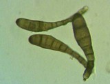 Helminthosporium velutinum image
