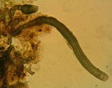 Helminthosporium velutinum image