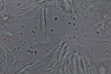 Rhytisma punctatum image