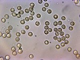 Lycogala epidendrum image