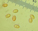 Truncocolumella citrina image